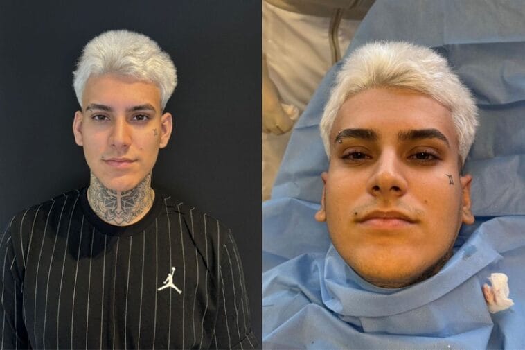 Arthur Urach admite que fez cirurgia na orelha para se sentir mais sexy scaled POP CYBER